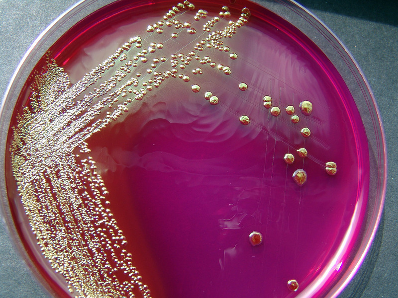 E-coli
